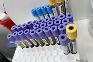 У 34 казахстанцев диагностировали COVID-19 