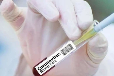 Почему отменили ПЦР-тесты для авиапассажиров в Казахстане. Ответ Тугжанова 