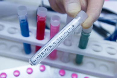 УЗ: коронавирус у находящихся под наблюдением казахстанцев и китайцев в ВКО не обнаружен 